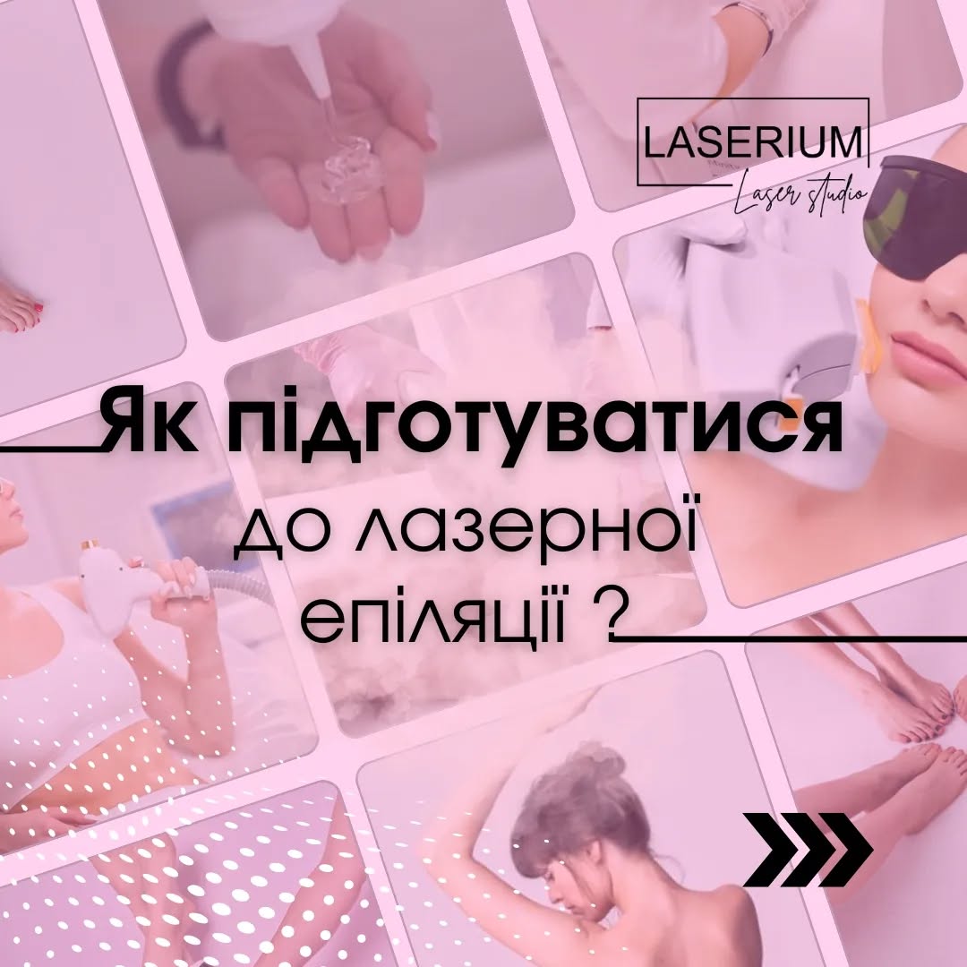 як підготуватися до лазерної епіляції